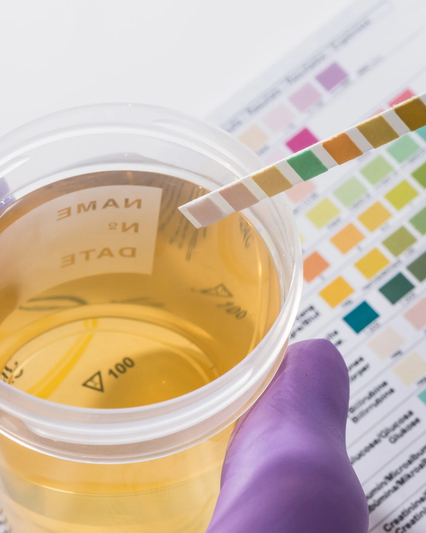 Ensuring Precision in Sample Collection