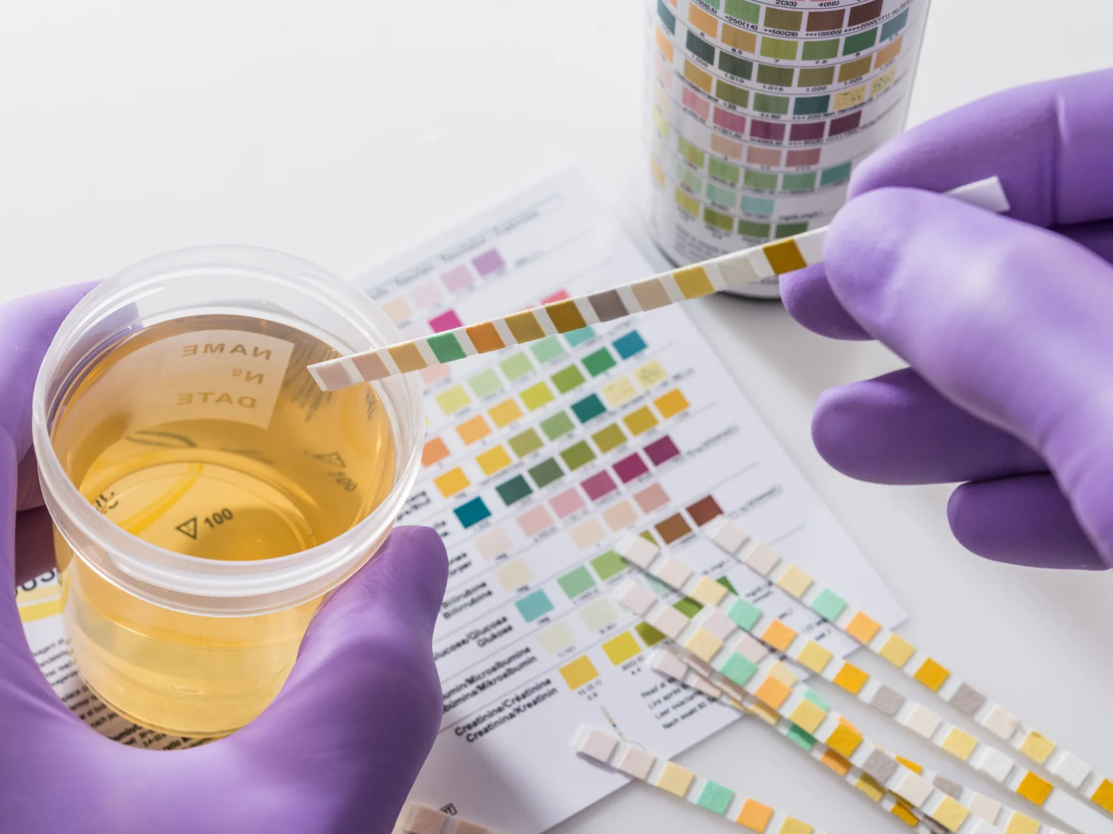 Pros and Cons of Urine Drug Testing in the Workplace
