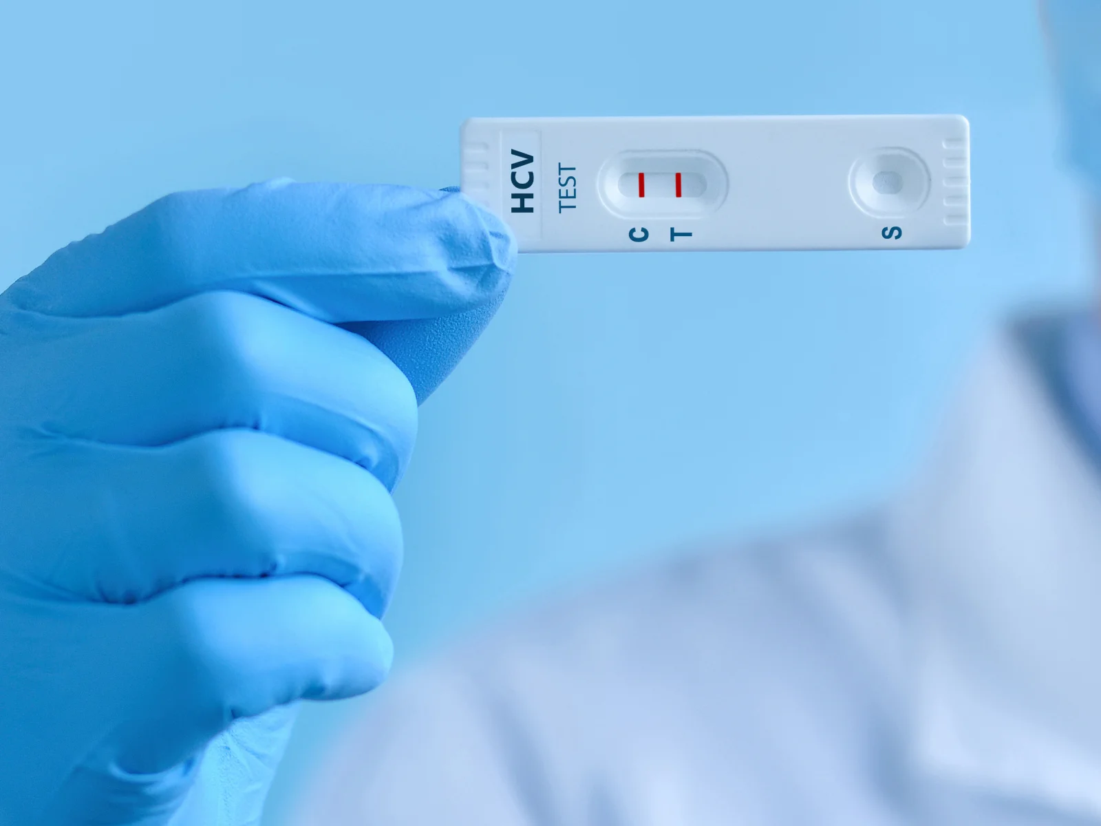 The Importance of Delivering BBV Test Results in a Controlled Environment